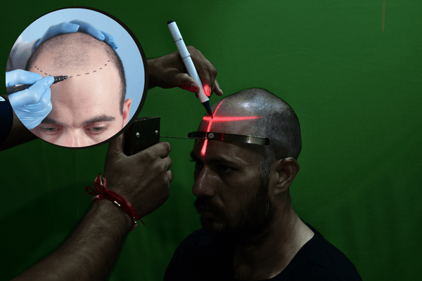 hair line drawer