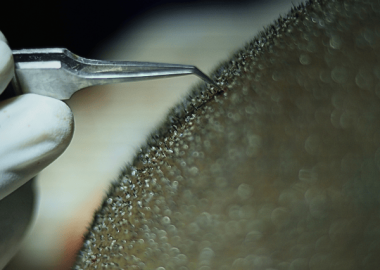 hair transplant forceps