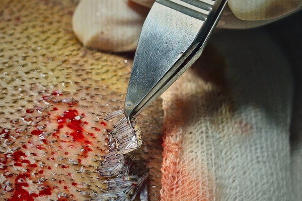 hair transplant extraction forcep