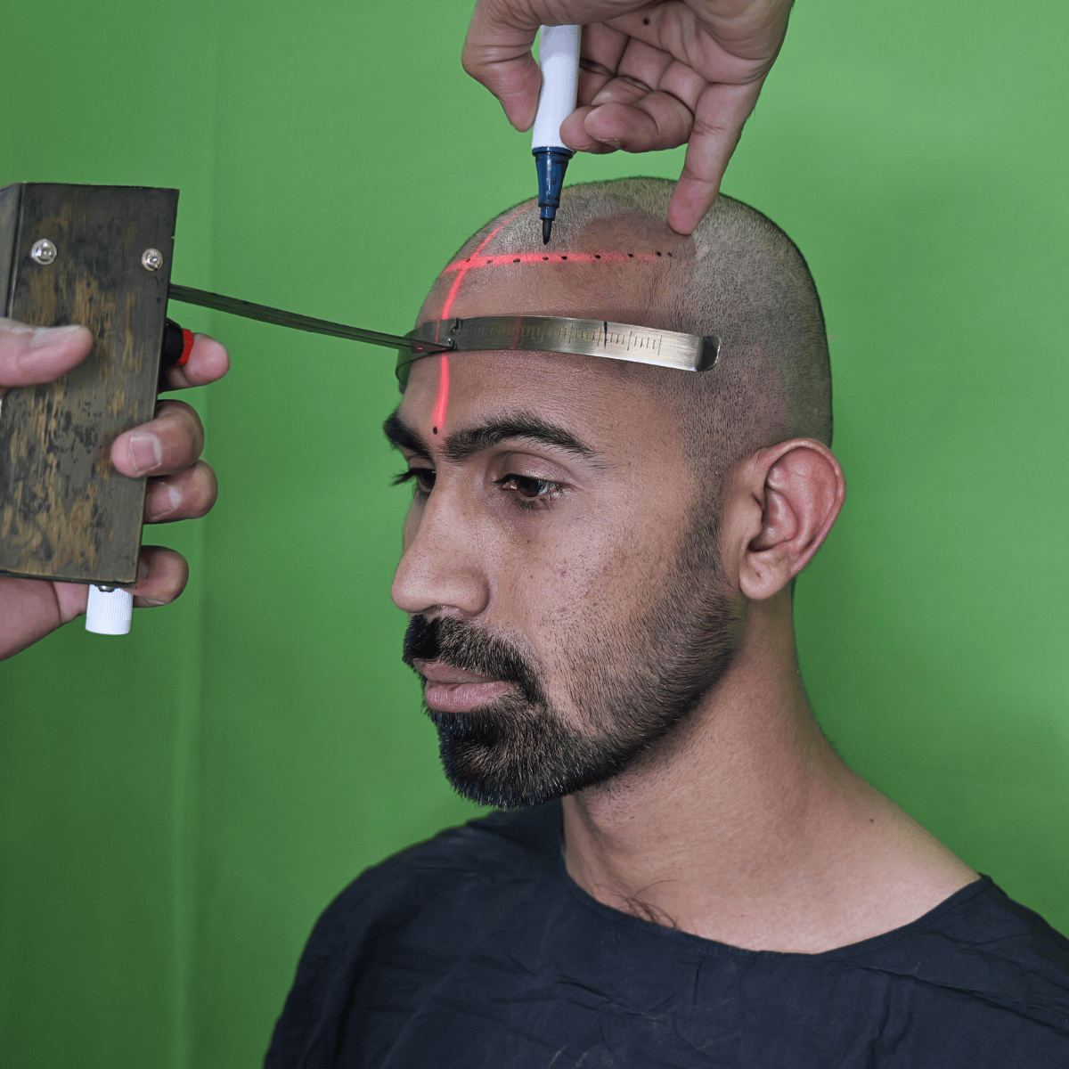 laser hair line device