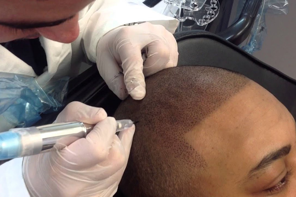 hair line drawer