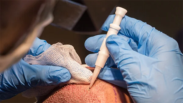 DHI hair transplant instruments