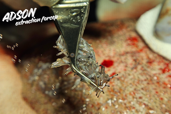 adson extraction forcep