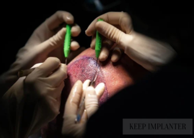 KEEP IMPLANTER MANUFACTURER IN INDIA