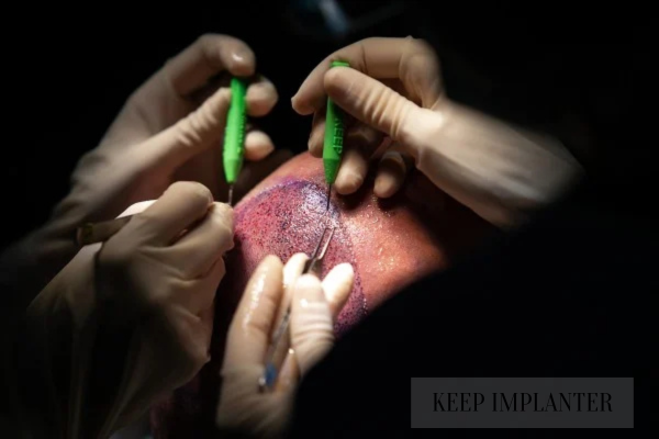 KEEP IMPLANTER MANUFACTURER IN INDIA