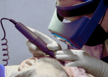 HAIR TRANSPLANT INSTRUMENTS MANUFACTURER