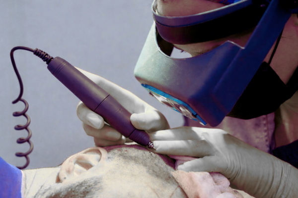 HAIR TRANSPLANT INSTRUMENTS MANUFACTURER